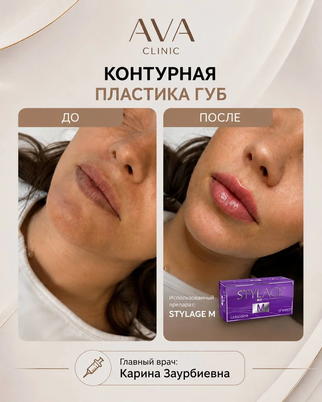По традиции раз в месяц мы показываем результаты ДО/ПОСЛЕ наших врачей-косметологов ✨