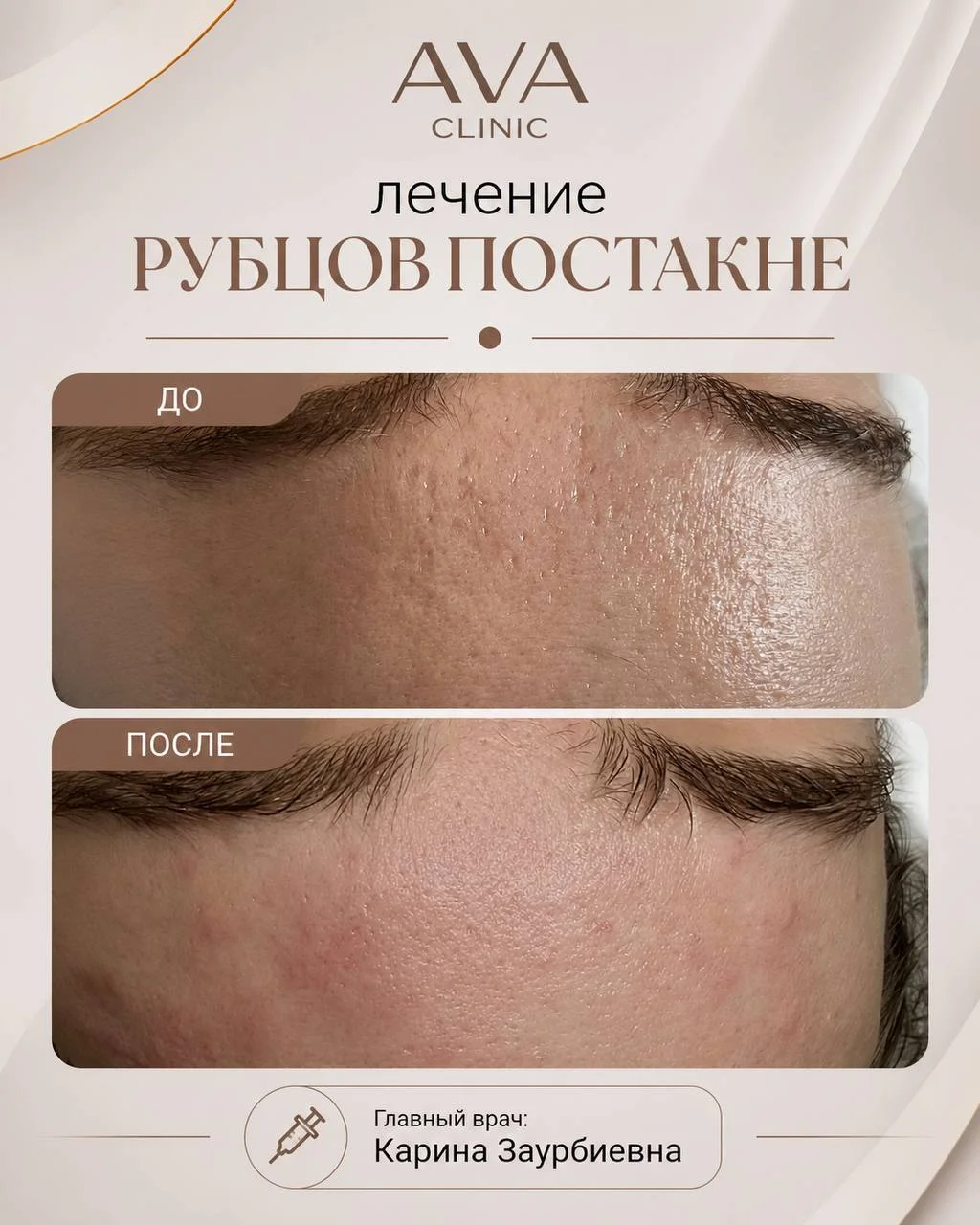 По традиции раз в месяц мы показываем результаты ДО/ПОСЛЕ наших врачей-косметологов ✨