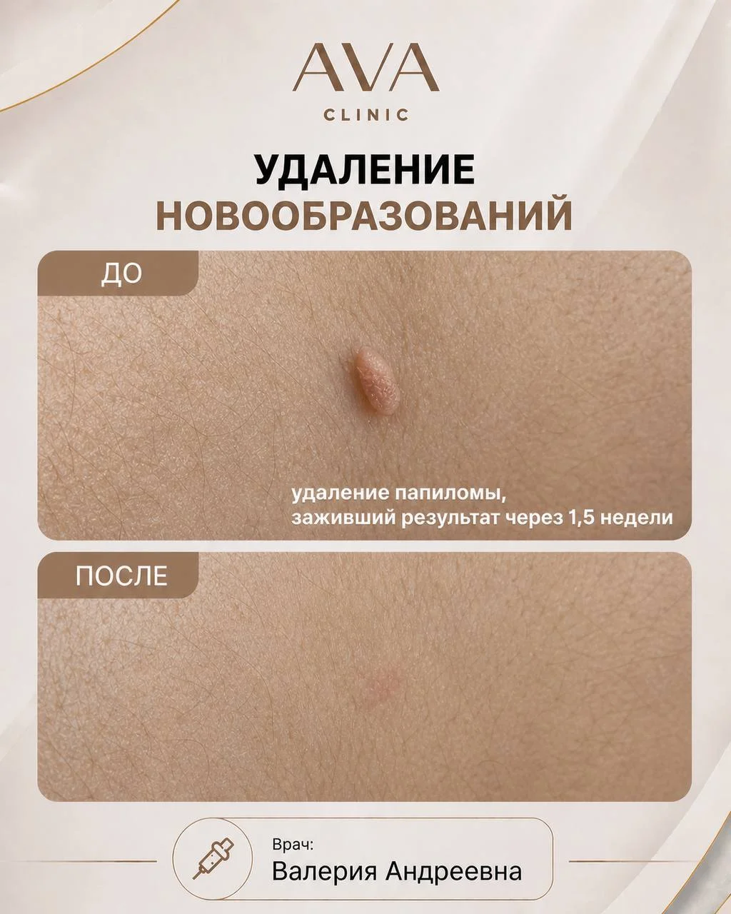 По традиции раз в месяц мы показываем результаты ДО/ПОСЛЕ наших врачей-косметологов ✨