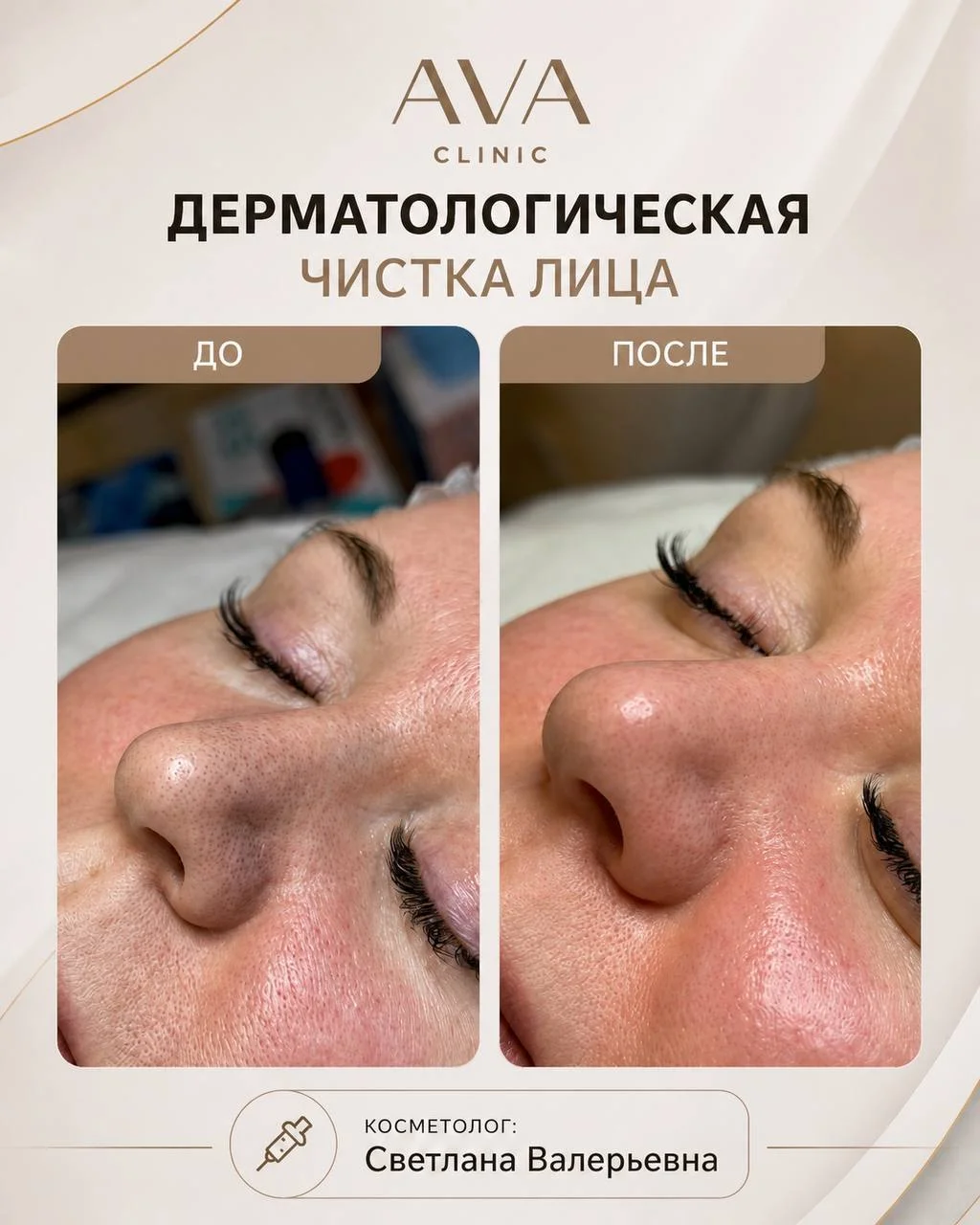 По традиции раз в месяц мы показываем результаты ДО/ПОСЛЕ наших врачей-косметологов ✨