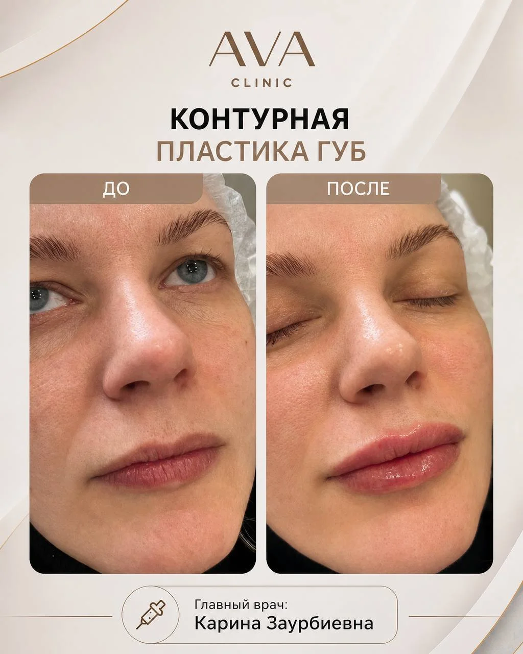По традиции раз в месяц мы показываем результаты ДО/ПОСЛЕ наших врачей-косметологов ✨