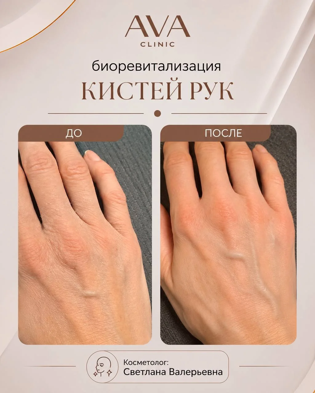 По традиции раз в месяц мы показываем результаты ДО/ПОСЛЕ наших врачей-косметологов ✨