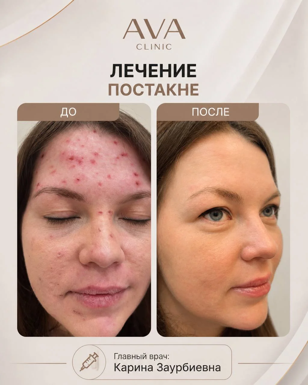 По традиции раз в месяц мы показываем результаты ДО/ПОСЛЕ наших врачей-косметологов ✨