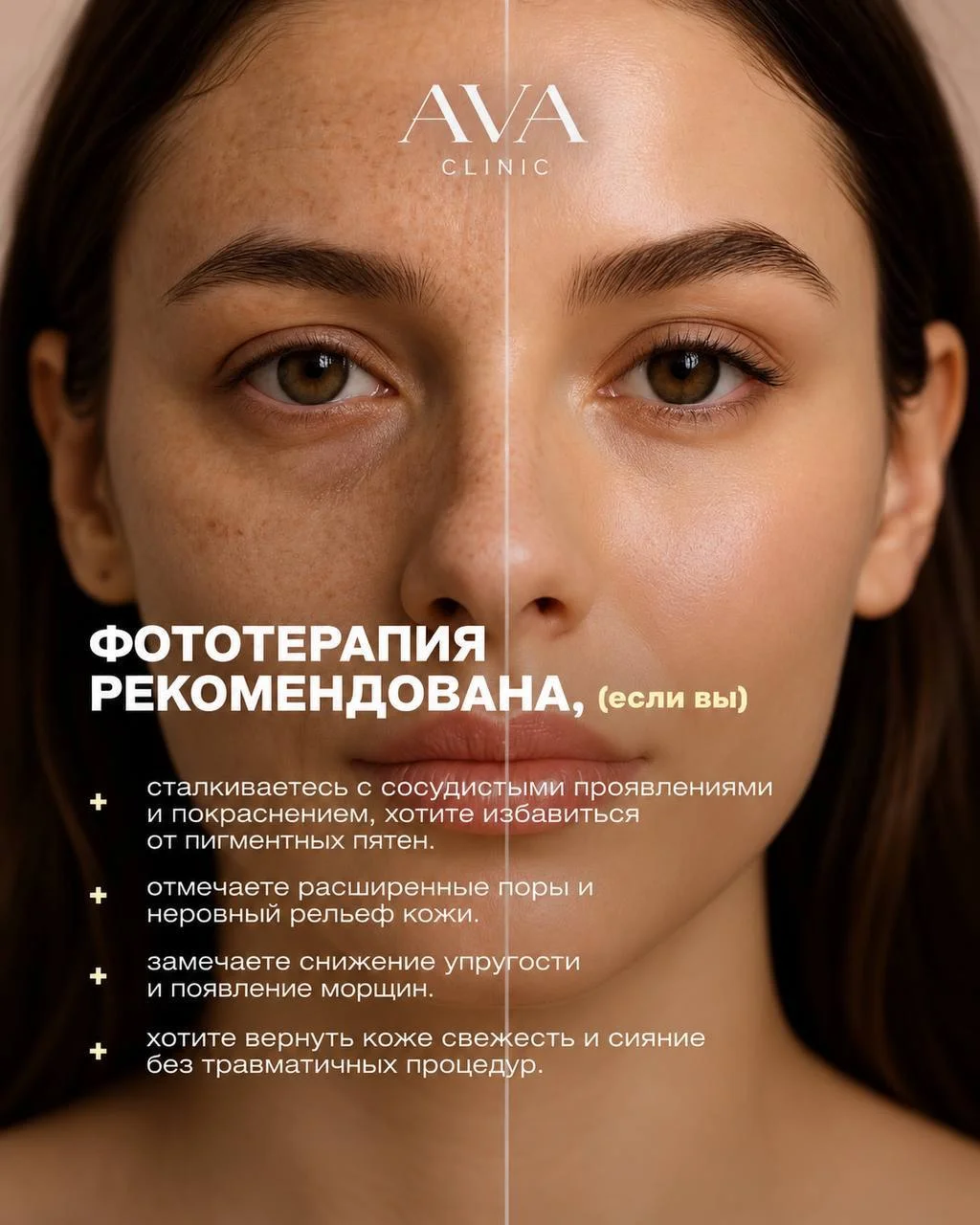 Пигментация, сосудистые звёздочки, тусклый цвет лица — кажется, что всё это можно только скрывать