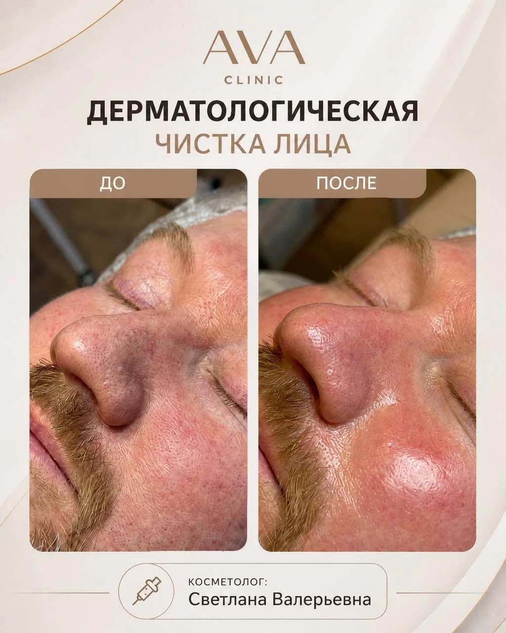 По традиции раз в месяц мы показываем результаты ДО/ПОСЛЕ наших врачей-косметологов ✨