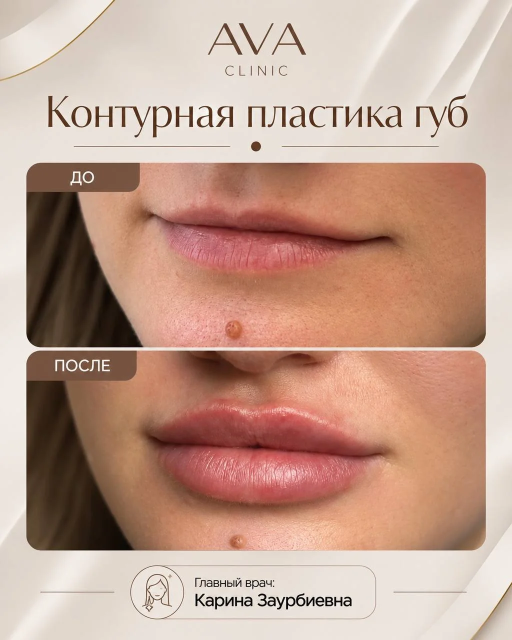 По традиции раз в месяц мы показываем результаты ДО/ПОСЛЕ наших врачей-косметологов ✨