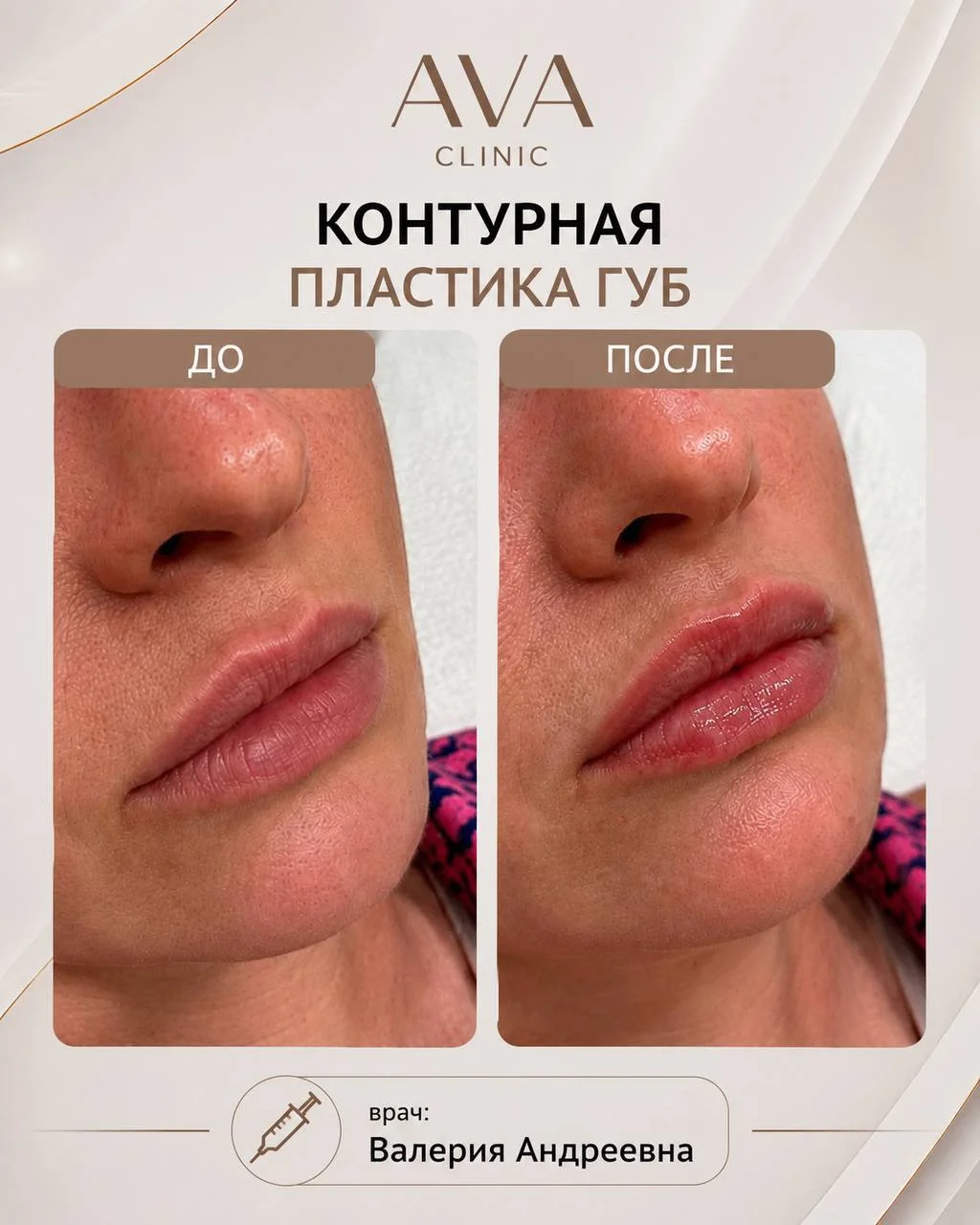 По традиции раз в месяц мы показываем результаты ДО/ПОСЛЕ наших врачей-косметологов ✨