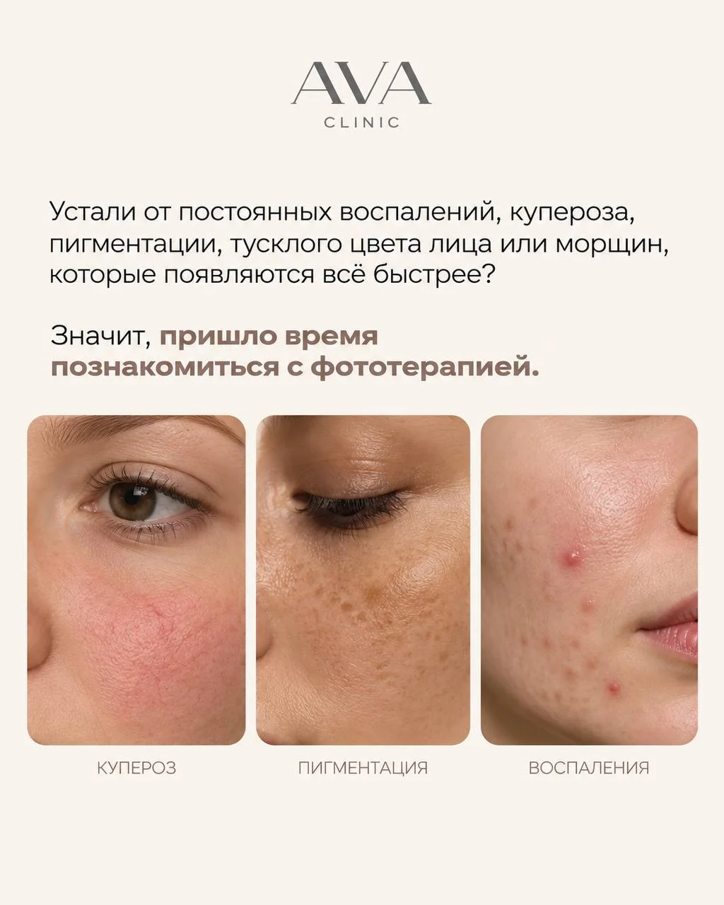 Пигментация, сосудистые звёздочки, тусклый цвет лица — кажется, что всё это можно только скрывать