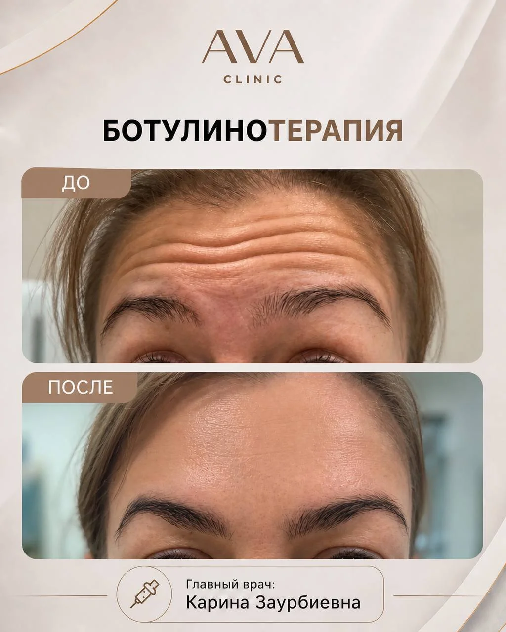 По традиции раз в месяц мы показываем результаты ДО/ПОСЛЕ наших врачей-косметологов ✨