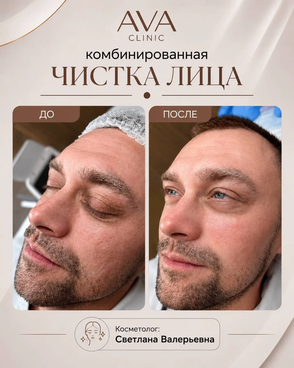 По традиции раз в месяц мы показываем результаты ДО/ПОСЛЕ наших врачей-косметологов ✨