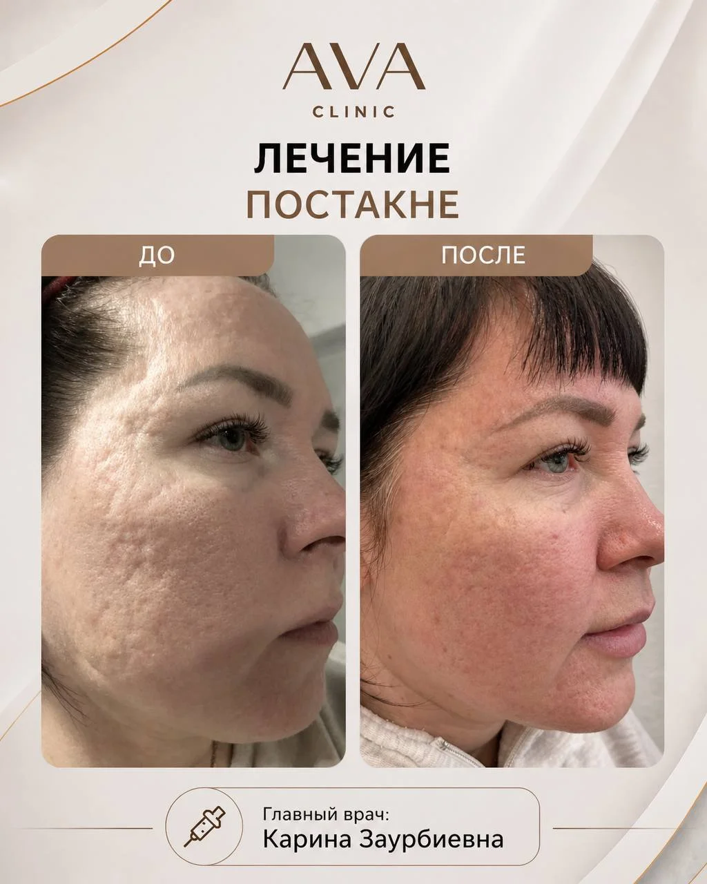 По традиции раз в месяц мы показываем результаты ДО/ПОСЛЕ наших врачей-косметологов ✨