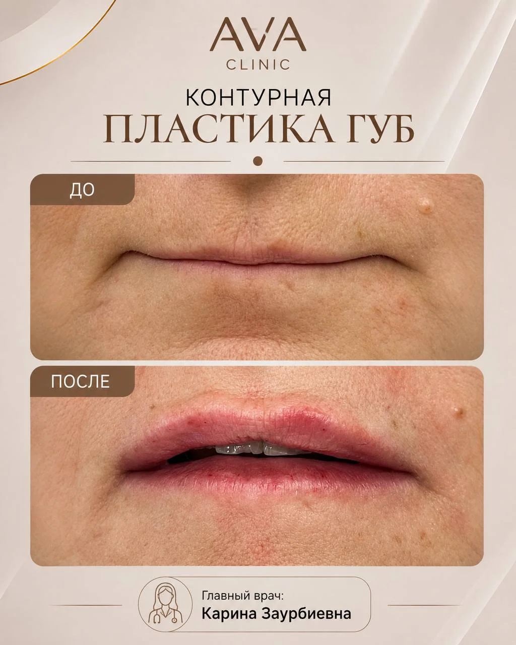 По традиции раз в месяц мы показываем результаты ДО/ПОСЛЕ наших врачей-косметологов ✨