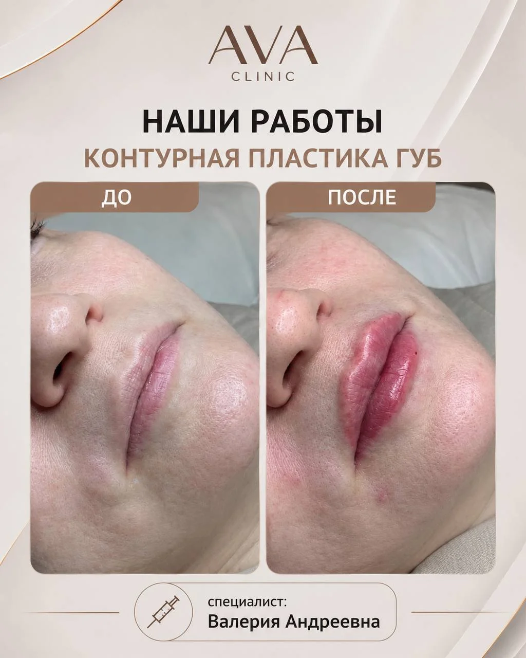 По традиции раз в месяц мы показываем результаты ДО/ПОСЛЕ наших врачей-косметологов ✨