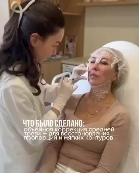 Минус несколько лет — всего за 3 процедуры ✨