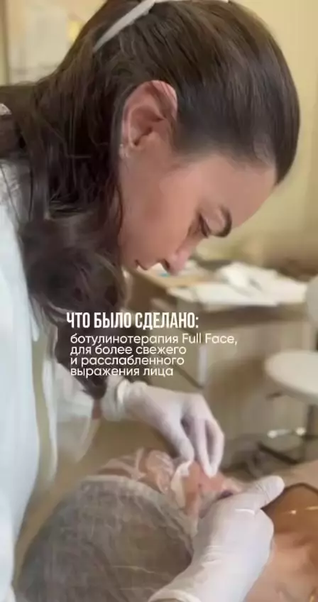 Минус несколько лет — всего за 3 процедуры ✨
