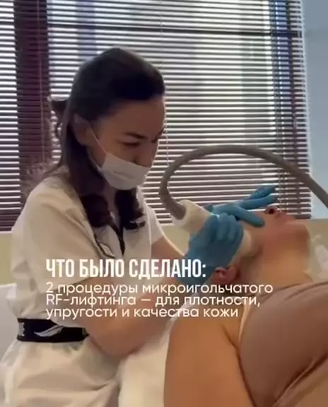 Минус несколько лет — всего за 3 процедуры ✨