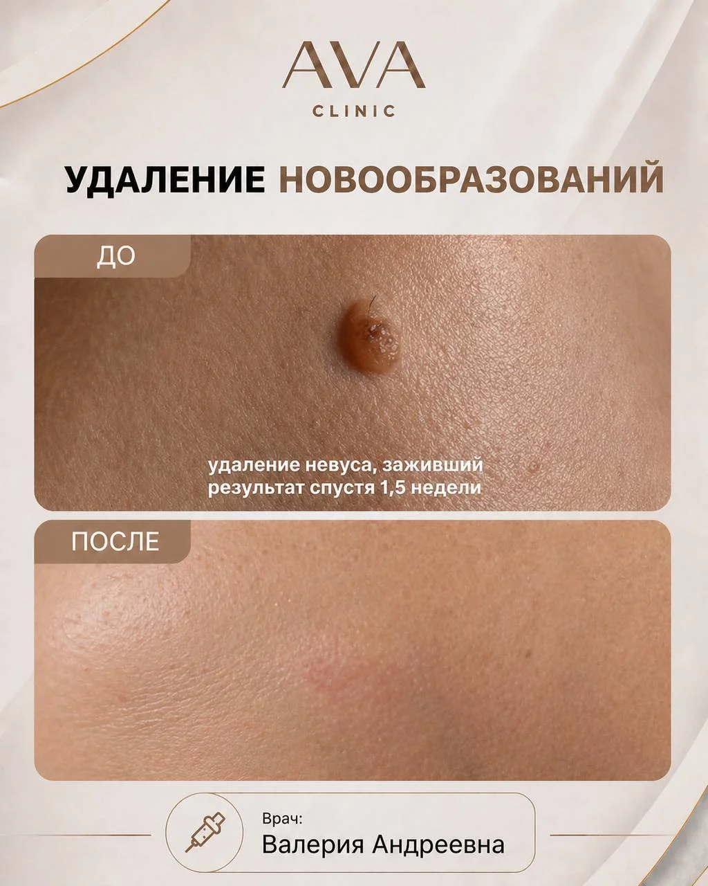 По традиции раз в месяц мы показываем результаты ДО/ПОСЛЕ наших врачей-косметологов ✨