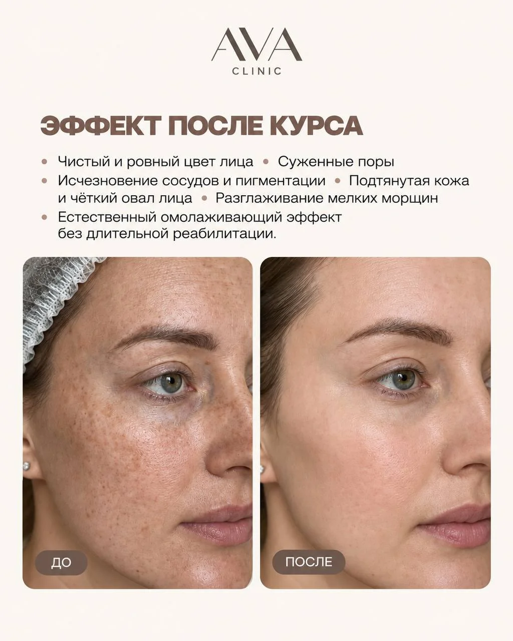 Пигментация, сосудистые звёздочки, тусклый цвет лица — кажется, что всё это можно только скрывать